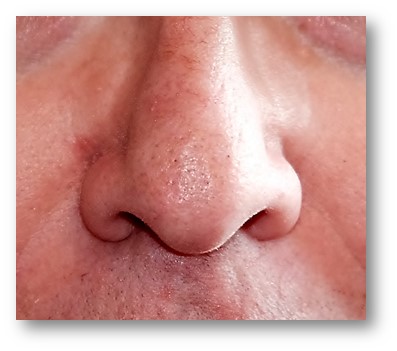 Nase Duftmarketing Aromatherapie.jpg